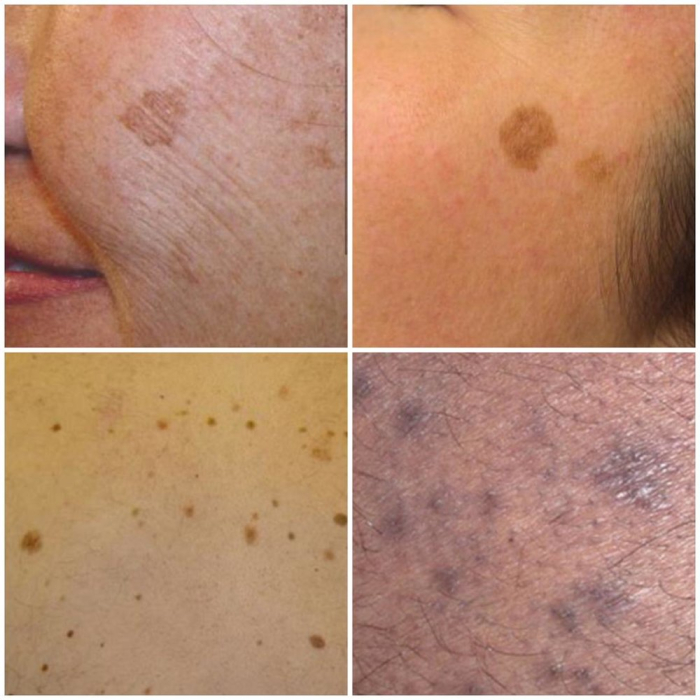 Register for our Virtual Skin Classic Training Course